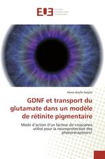 GDNF et transport du glutamate dans un modèle de rétinite pigmentaire