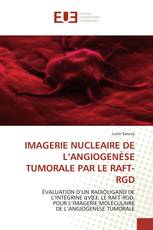 IMAGERIE NUCLEAIRE DE L’ANGIOGENÈSE TUMORALE PAR LE RAFT-RGD