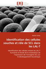 Identification des cellules souches et rôle de SCL dans les LAL-T