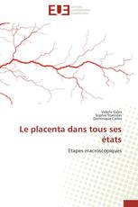 Le placenta dans tous ses états