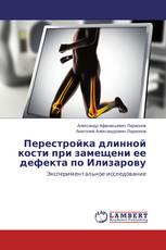 Перестройка длинной кости при замещени ее дефекта по Илизарову
