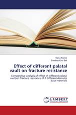Effect of different palatal vault on fracture resistance
