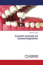Current concept on Osseointegration