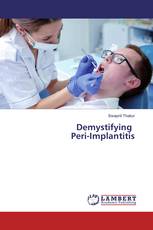 Demystifying Peri-Implantitis