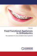 Fixed Functional Appliances In Orthodontics