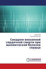 Синдром внезапной сердечной смерти при ишемической болезни сердца