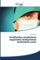 Antibiotikus prophylaxis nagyízületi endoprotézis beültetések során