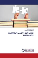 BIOMECHANICS OF MINI IMPLANTS