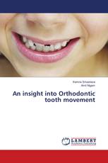 An insight into Orthodontic tooth movement