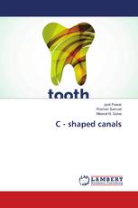 C - shaped canals