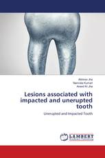 Lesions associated with impacted and unerupted tooth