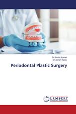Periodontal Plastic Surgery