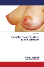 Galactorrhea: Pituitary gland disorder