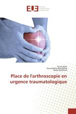 Place de l'arthroscopie en urgence traumatologique