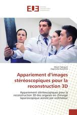 Appariement d’images stéréoscopiques pour la reconstruction 3D