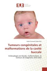 Tumeurs congénitales et malformations de la cavité buccale