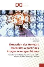 Extraction des tumeurs cérébrales à partir des images scanographiques