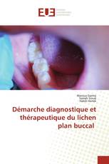 Démarche diagnostique et thérapeutique du lichen plan buccal