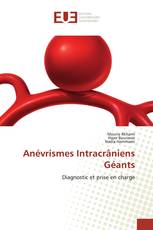 Anévrismes Intracrâniens Géants