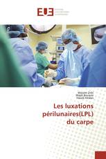 Les luxations périlunaires(LPL) du carpe