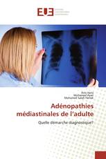 Adénopathies médiastinales de l’adulte