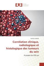 Corrélation clinique, radiologique et histologique des tumeurs du sein