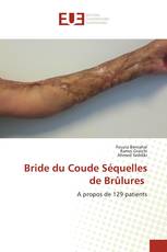 Bride du Coude Séquelles de Brûlures