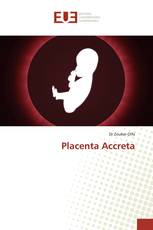 Placenta Accreta