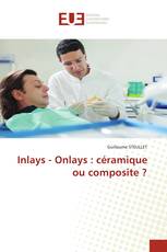 Inlays - Onlays : céramique ou composite ?