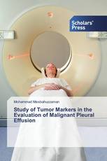 Study of Tumor Markers in the Evaluation of Malignant Pleural Effusion