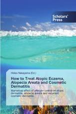 How to Treat Atopic Eczema, Alopecia Areata and Cosmetic Dermatitis