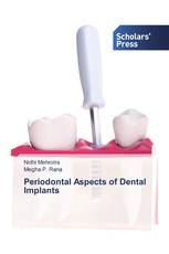 Periodontal Aspects of Dental Implants