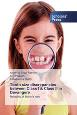 Tooth size discrepancies between Class I & Class II in Davangere