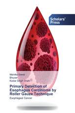 Primary Detection of Esophagus Carcinoma by Roller Gauze Technique