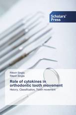 Role of cytokines in orthodontic tooth movement