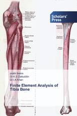 Finite Element Analysis of Tibia Bone