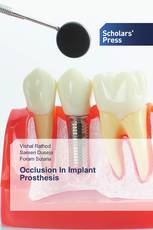 Occlusion In Implant Prosthesis