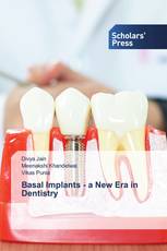 Basal Implants - a New Era in Dentistry