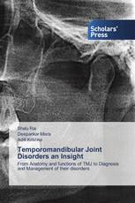 Temporomandibular Joint Disorders an Insight