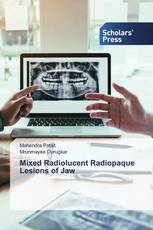 Mixed Radiolucent Radiopaque Lesions of Jaw