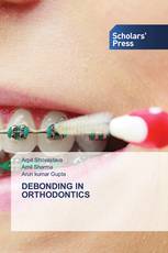 DEBONDING IN ORTHODONTICS