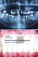 Dental Implant Impressions