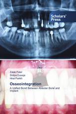 Osseointegration