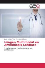 Imagen Multimodal en Amiloidosis Cardíaca