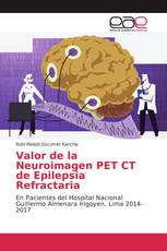Valor de la Neuroimagen PET CT de Epilepsia Refractaria