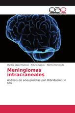 Meningiomas intracraneales