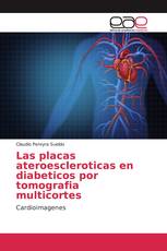 Las placas ateroescleroticas en diabeticos por tomografia multicortes