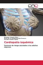 Cardiopatía isquémica