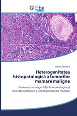 Heterogenitatea histopatologică a tumorilor mamare maligne