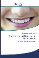 Onzichtbare uitlijners in de orthodontie